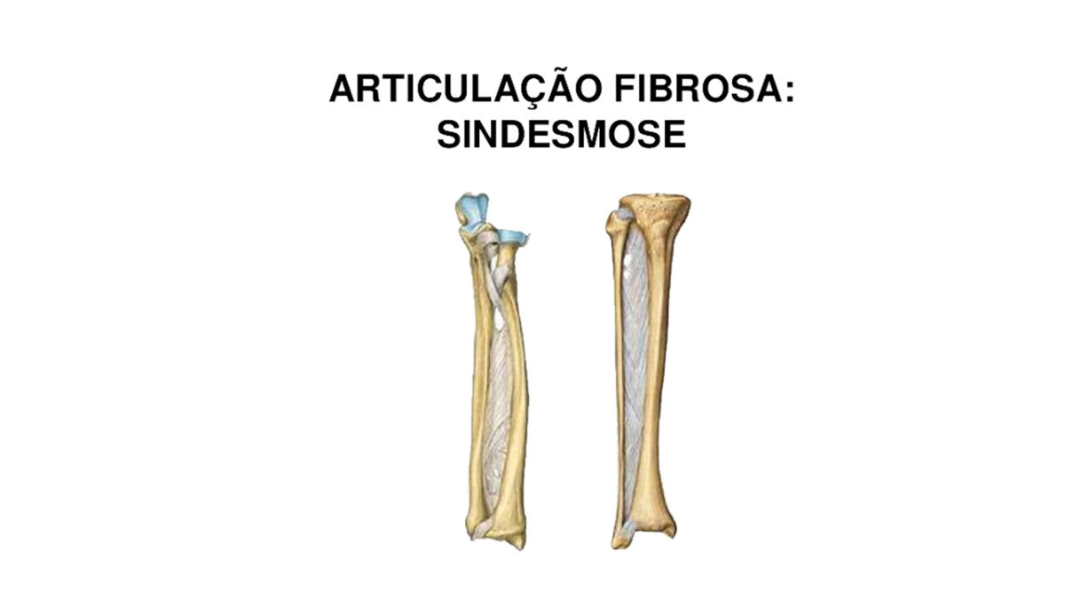 É possível fortalecer as articulações realizando sessões de musculação?